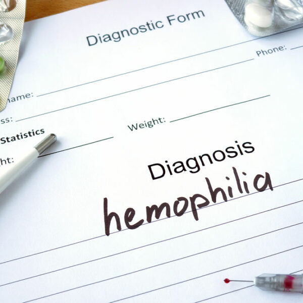 4 essential tips for healthy living with hemophilia