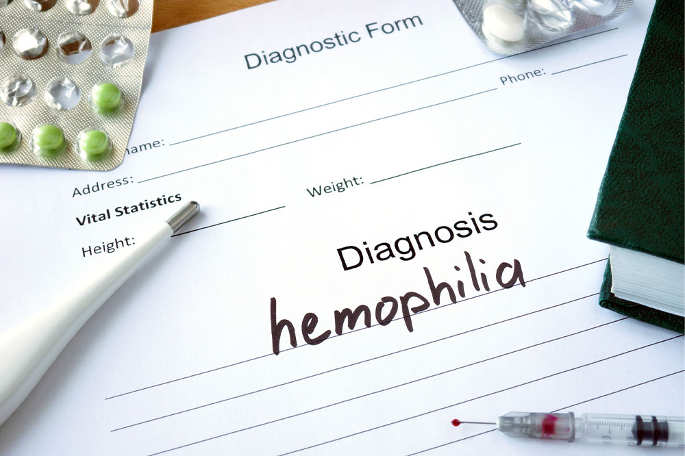 4 essential tips for healthy living with hemophilia