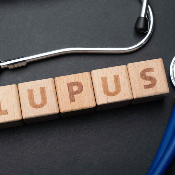 4 things to avoid when dealing with lupus