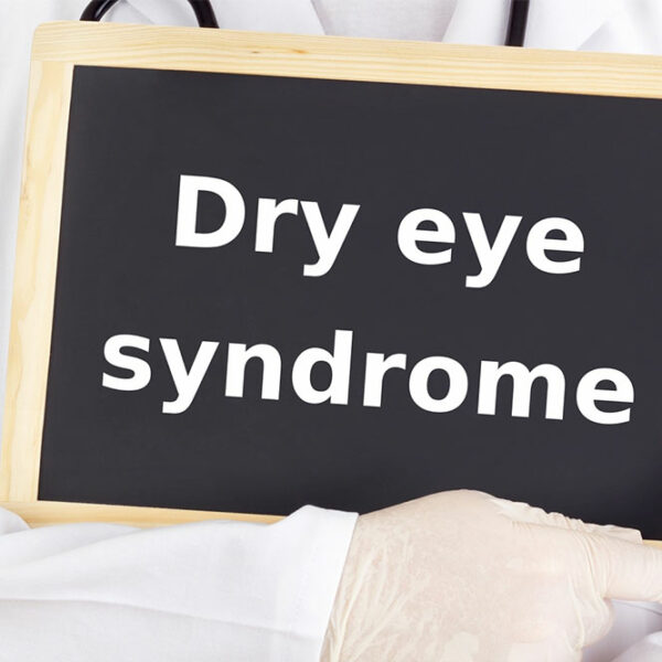 5 natural ways to manage dry eye syndrome