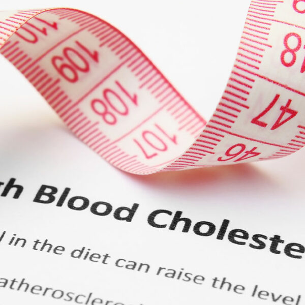 5 signs indicative of high cholesterol levels in the body