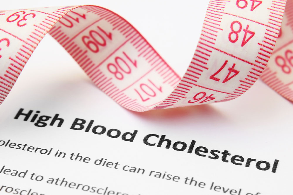 5 signs indicative of high cholesterol levels in the body