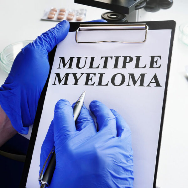 10 warning signs for the onset of multiple myeloma