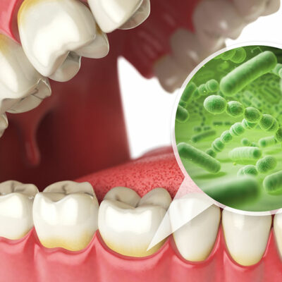 3 edibles that are beneficial for oral health