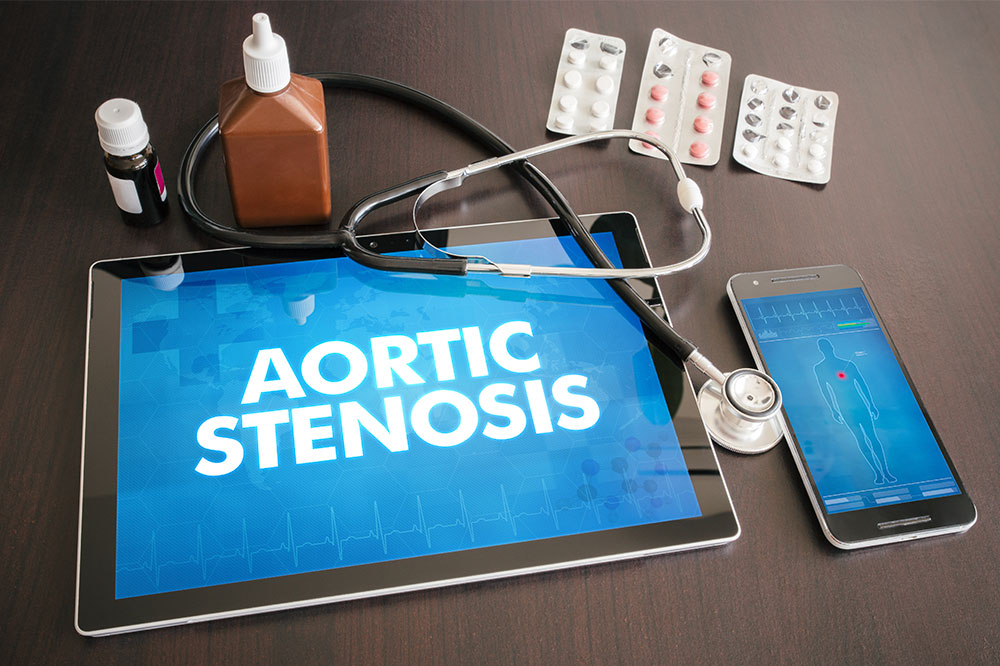 Aortic stenosis- Symptoms, diagnosis, and management