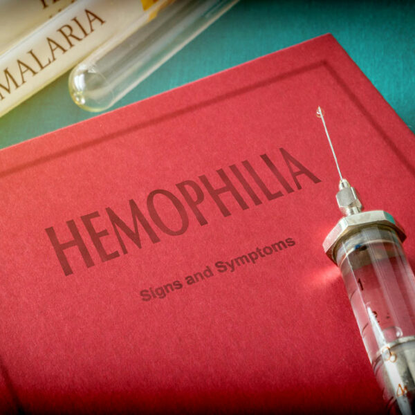 Hemophilia &#8211; Symptoms to look out for